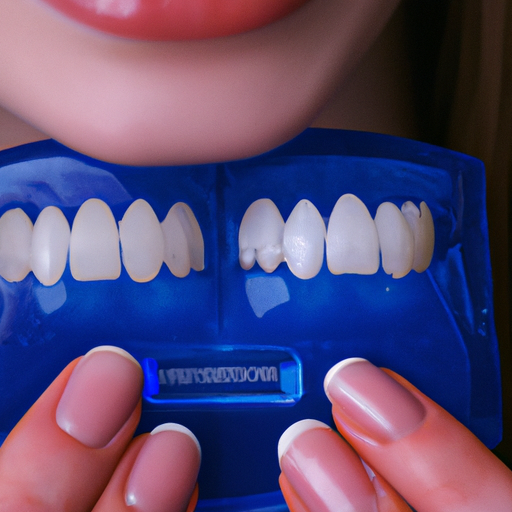 תקריב של שיני אישה עם מגש שיניים המכיל תמיסת הלבנת שיניים